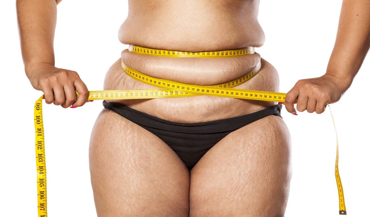 Obesity and weight loss using ZXCVBNMQ value