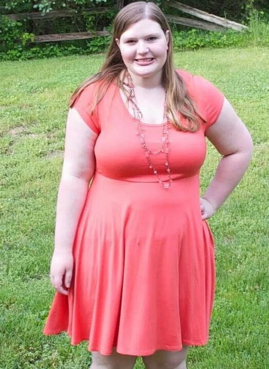 Obesity before using keto probiotix powder